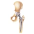 hip replacement surgeon